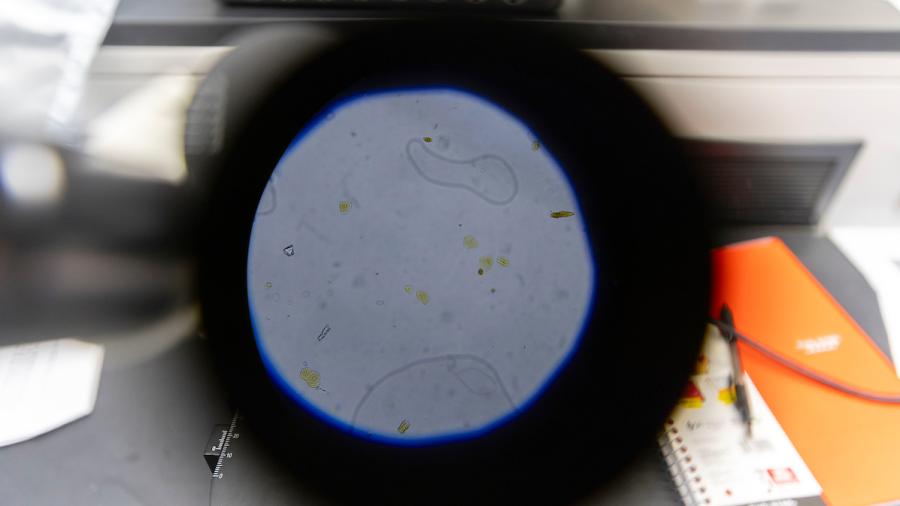 Viewing cells through a microscope lens